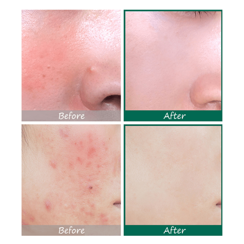 سوم باي مي - السيروم المعجزة 50 مل