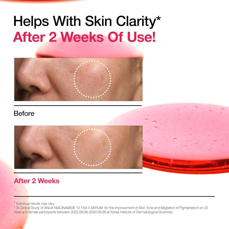 انوا - سيروم النياسيناميد لتصحيح البقع الداكنة 30 مل