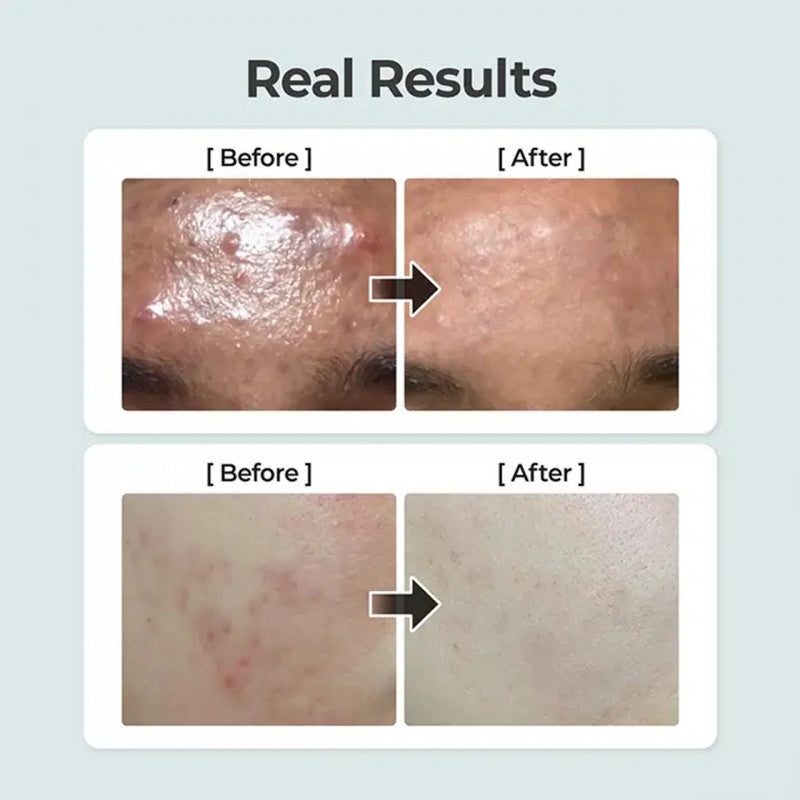 نومبوزين‏ - تونر 1 النباتي المهدئ للبشرة 300 مل